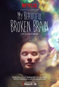 My Beautiful Broken Brain logo