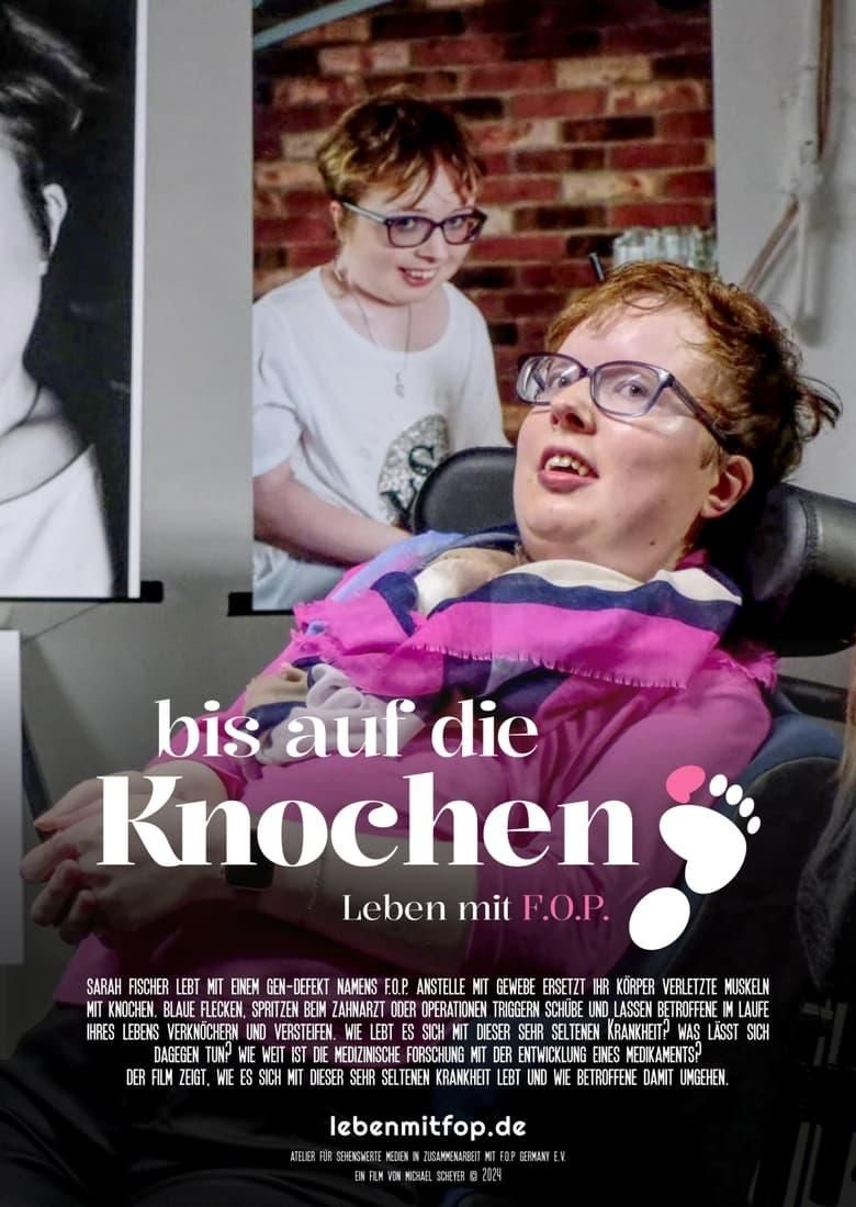 Bis auf die Knochen - Leben mit FOP poster image